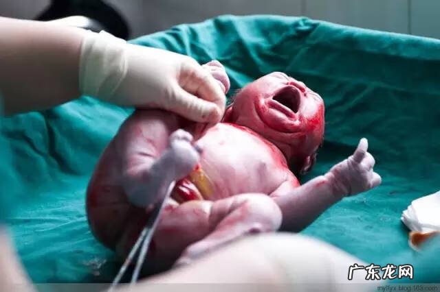 剖腹产全过程图解 剖腹产全过程的图片