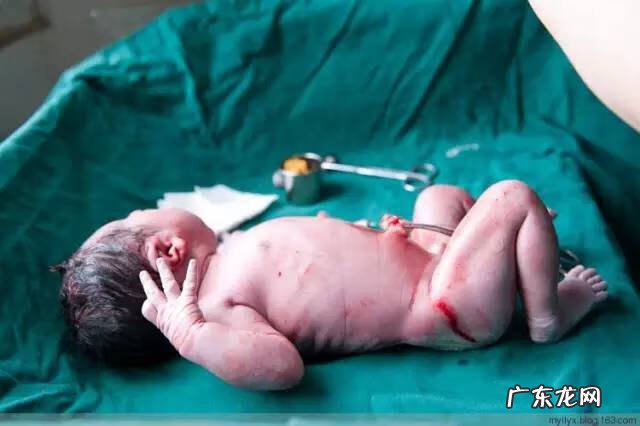 剖腹产全过程图解 剖腹产全过程的图片