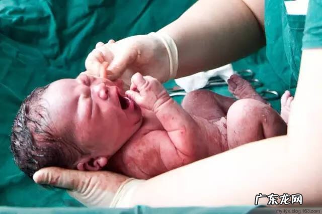 剖腹产全过程图解 剖腹产全过程的图片