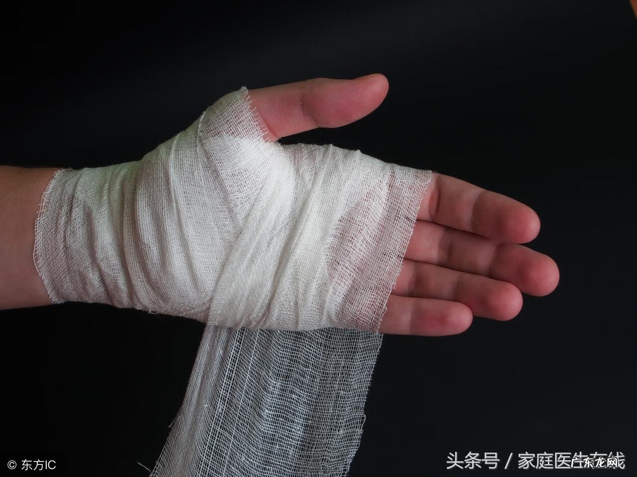 烫伤留下的白色疤痕能淡化吗 烫伤后起水泡怎么处理不留疤痕的