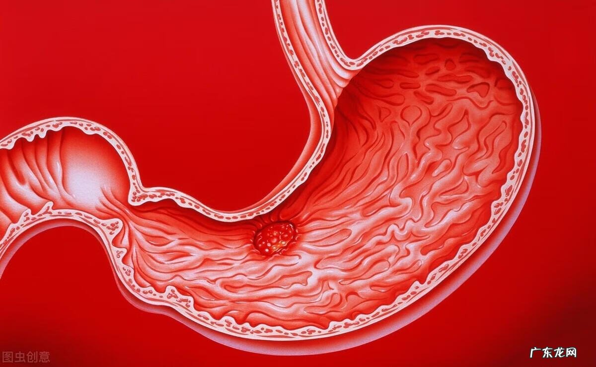 十二指肠 位置 十二指肠溃疡