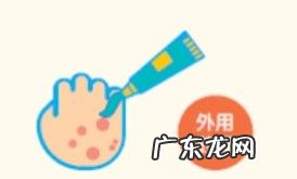 头皮牛皮皮癣怎么造成的 头皮有牛癣