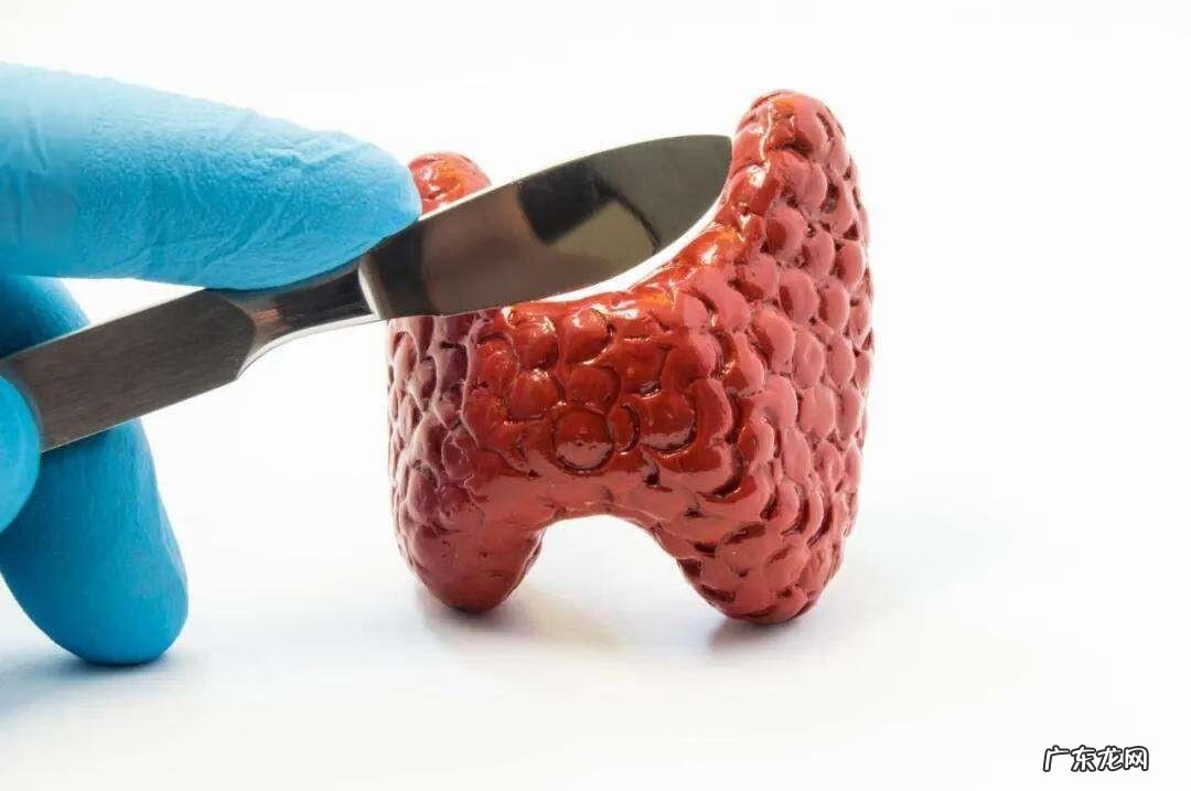 甲亢最佳的治疗方案 甲亢的治疗方案