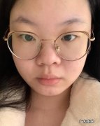 带你了解不好看的鼻型有哪些 小知识：公认最丑的鼻型是什么样的