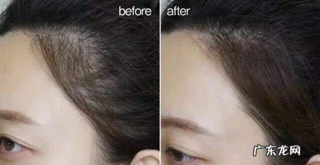 美人尖发际线 美人尖发际线怎么剪