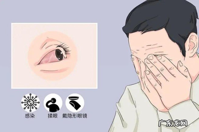 佩戴隐形眼镜注意事项 男子新婚夜忘摘隐形眼球变白眼睛看不见了