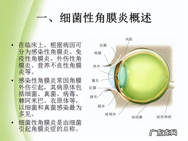 佩戴隐形眼镜注意事项 男子新婚夜忘摘隐形眼球变白眼睛看不见了