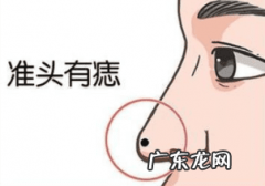 鼻子上有肉痣好不好 风水鼻子旁边的肉痣是好是坏的