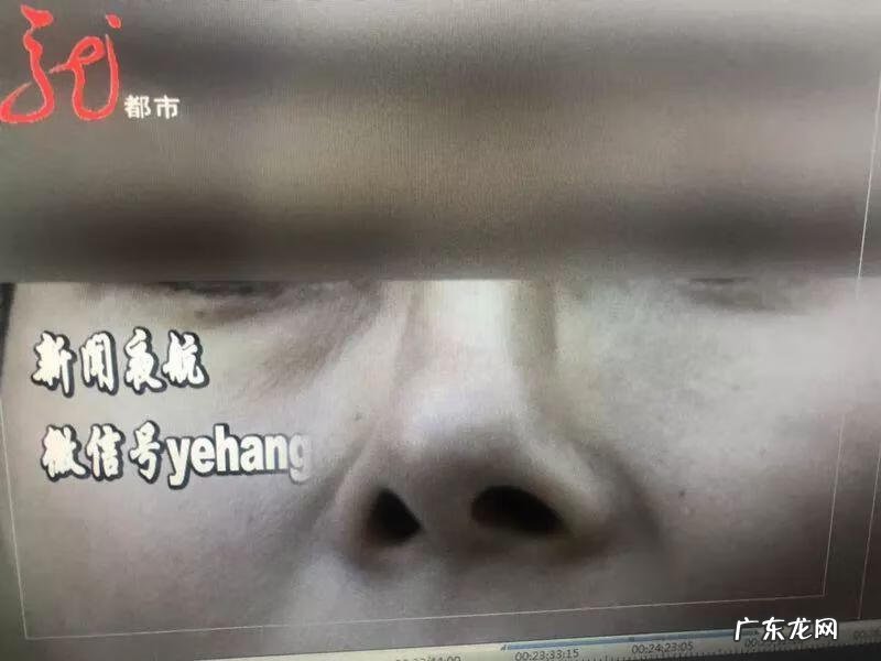 整容动了五官影响运气吗 风水整容多久起效果啊