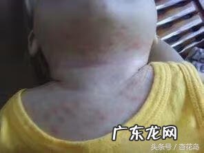 桃树枝煮水洗澡驱邪 桃树枝煮水洗澡的作用