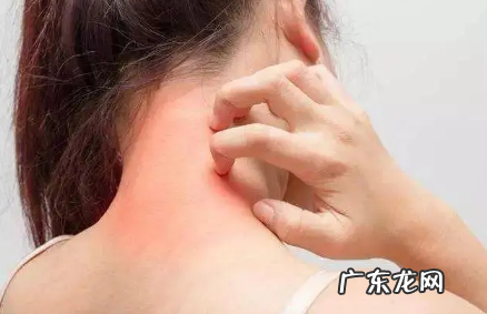 皮肤干燥如何快速补水