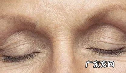 如何去掉眼底皱纹