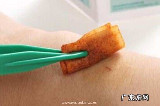 无水乙醇能擦伤口吗