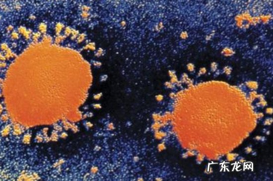 肺炎属于什么病毒