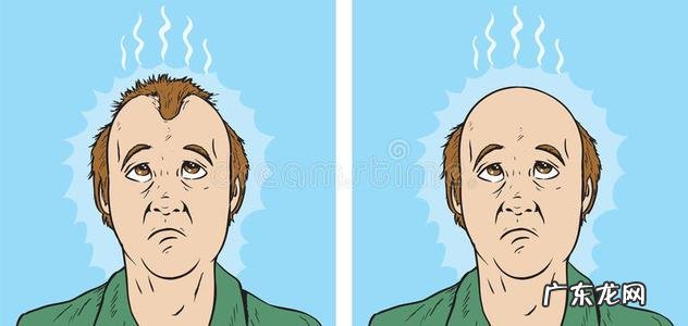 “秃”然来袭,该如何自救?