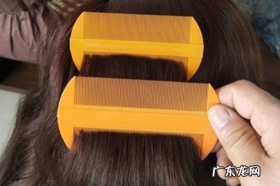 白酒去虱子的步骤