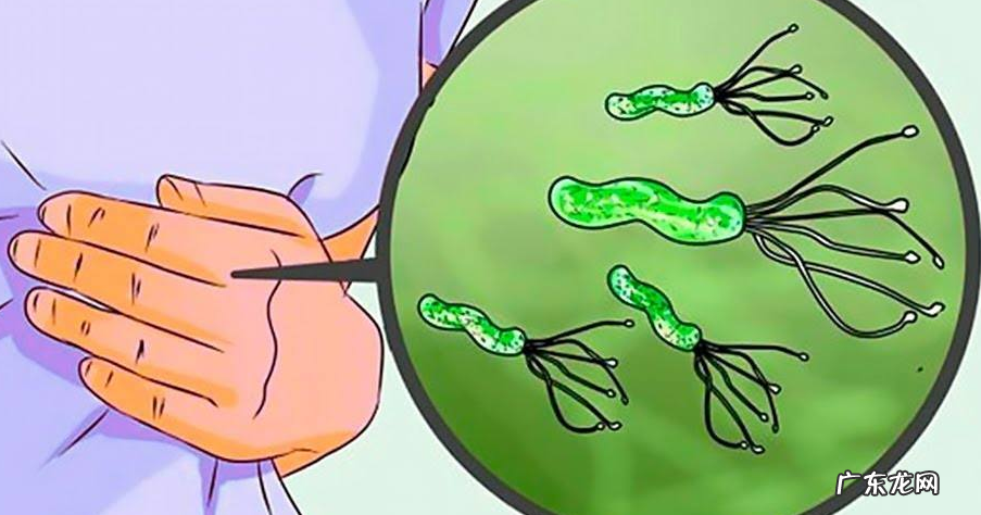 感染幽门螺杆菌到 感染幽门螺杆菌到胃癌需要几步