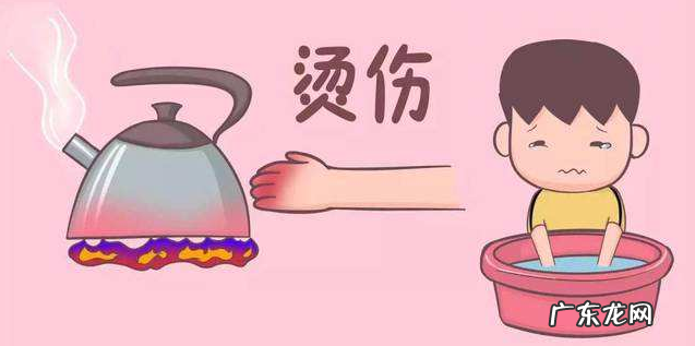 被烫伤后能用牙膏 被烫伤后能用牙膏吗