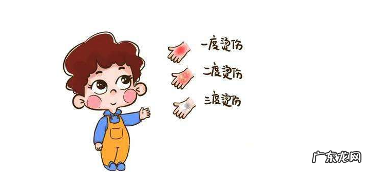 被烫伤后能用牙膏 被烫伤后能用牙膏吗