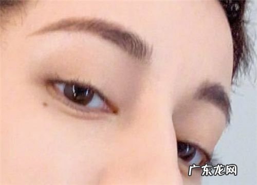 命太好的人眼睛要 命太好的人眼睛要留疤