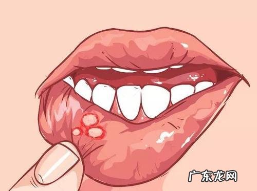 口腔溃疡吃甚么水 口腔溃疡吃什么水果好得快