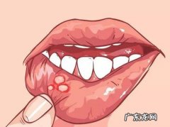 嘴里起泡可以扎破 嘴里起泡可以扎破吗