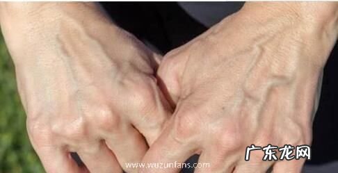 为何手上青筋很 为什么手上青筋很明显