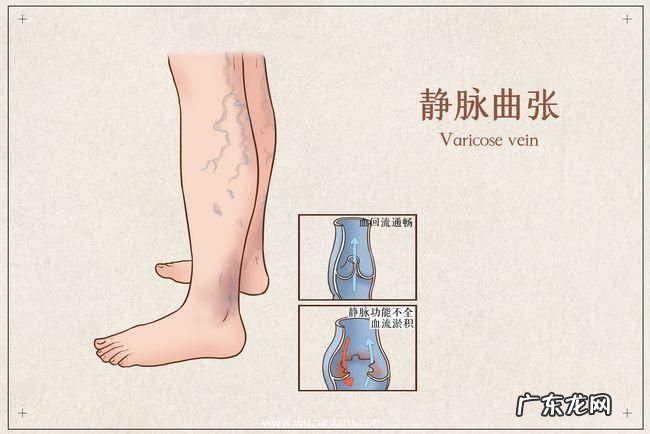 为何手上青筋很 为什么手上青筋很明显
