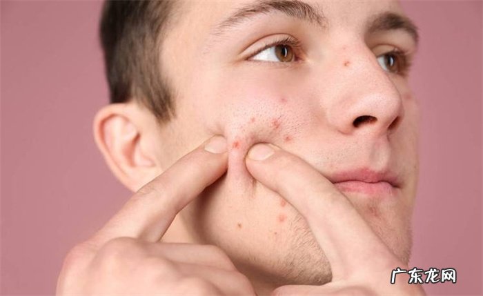 只需治疗有痘印的地方 青春痘治疗有几个误区