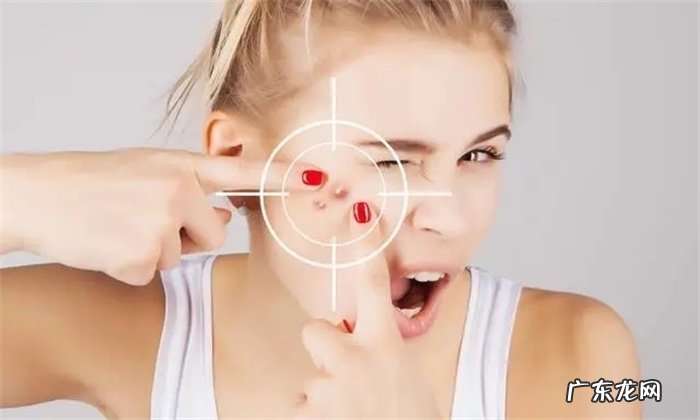 只需治疗有痘印的地方 青春痘治疗有几个误区