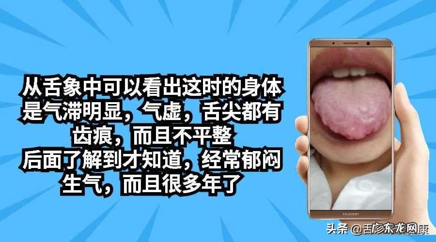 容易让头部受伤的风水 头不舒服的风水原因