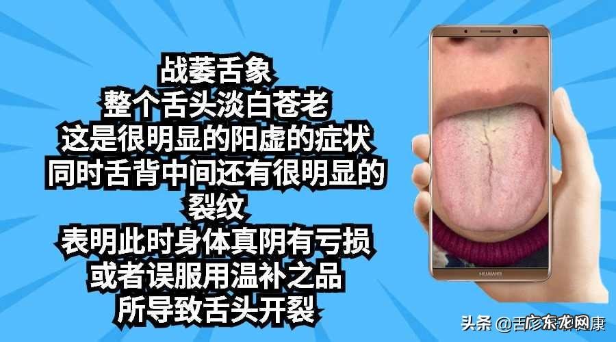 容易让头部受伤的风水 头不舒服的风水原因