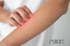 常见皮肤瘙痒的原因及治疗方法
