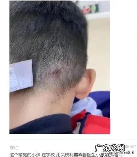 已刑拘 医生上门掌掴幼儿推倒老人已被刑拘
