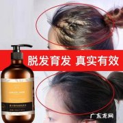 脱发严重,用什么洗发水防脱发效果好？这3个控油洗发水了解一下