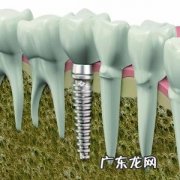 「牙齿那些事儿」No.28 安了种植牙嘴凸怎么办