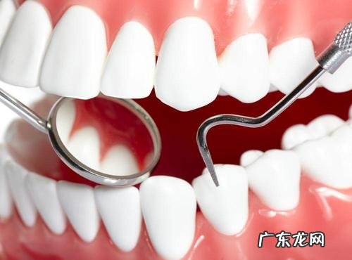 种植牙的3种方式 下门牙缺了三颗怎么种植
