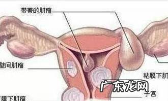 如何保养子宫和卵巢