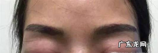 睡醒后眼睛很疼是什么原因