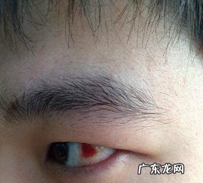 睡醒后眼睛很疼是什么原因