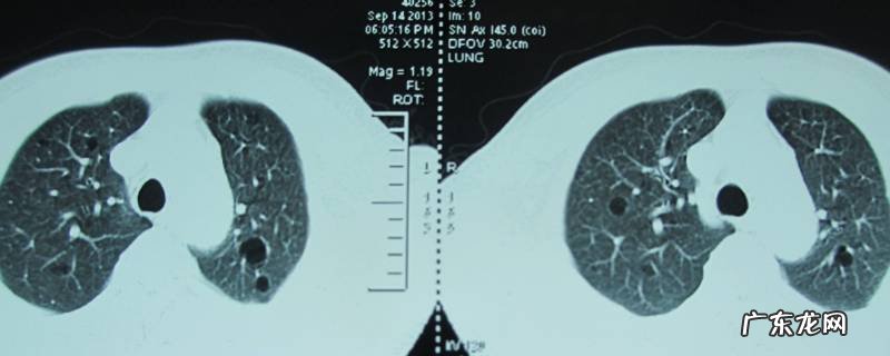 气之主指的是什么,气之主指的是哪个脏器