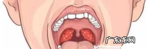 如何快速判断孩子猩红热经验浅谈