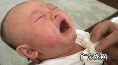 宝宝身上起的什么疙瘩宝宝起疙瘩的可能