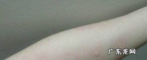 如何预防胎儿畸形