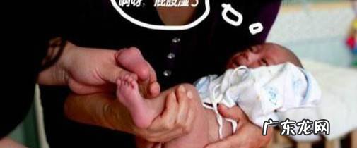 如何护理新生儿的红屁股