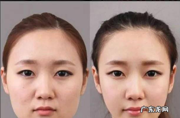 如何快速瘦脸