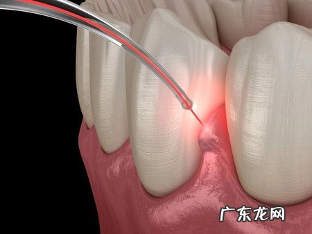 如何预防和治疗牙龈炎