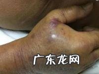 结果 暴躁求医者砸玻璃 医疗资源遇冲击波
