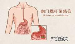 幽门螺杆菌会致癌吗 幽门螺旋杆菌为什么是致癌物