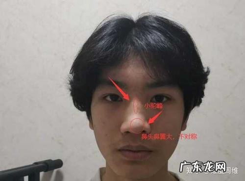鼻子大是什么原因造成的原因?如何改善?